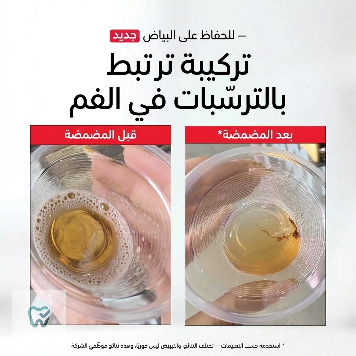 غسول فم للتبييض ببيروكسيد الهيدروجين – 237 مل، خالٍ من الكحول – Hismile iD