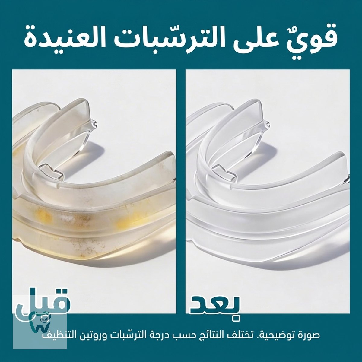 أقراص فوّارة لتنظيف التقويم والحافظات – 60 قرصًا (إمداد شهرين) – M3 Naturals