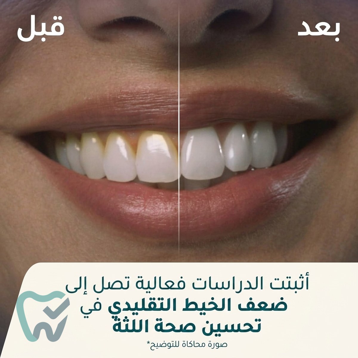 خيط مائي لاسلكي – ووتربيك كوردلس أدفانسد (WP-560)